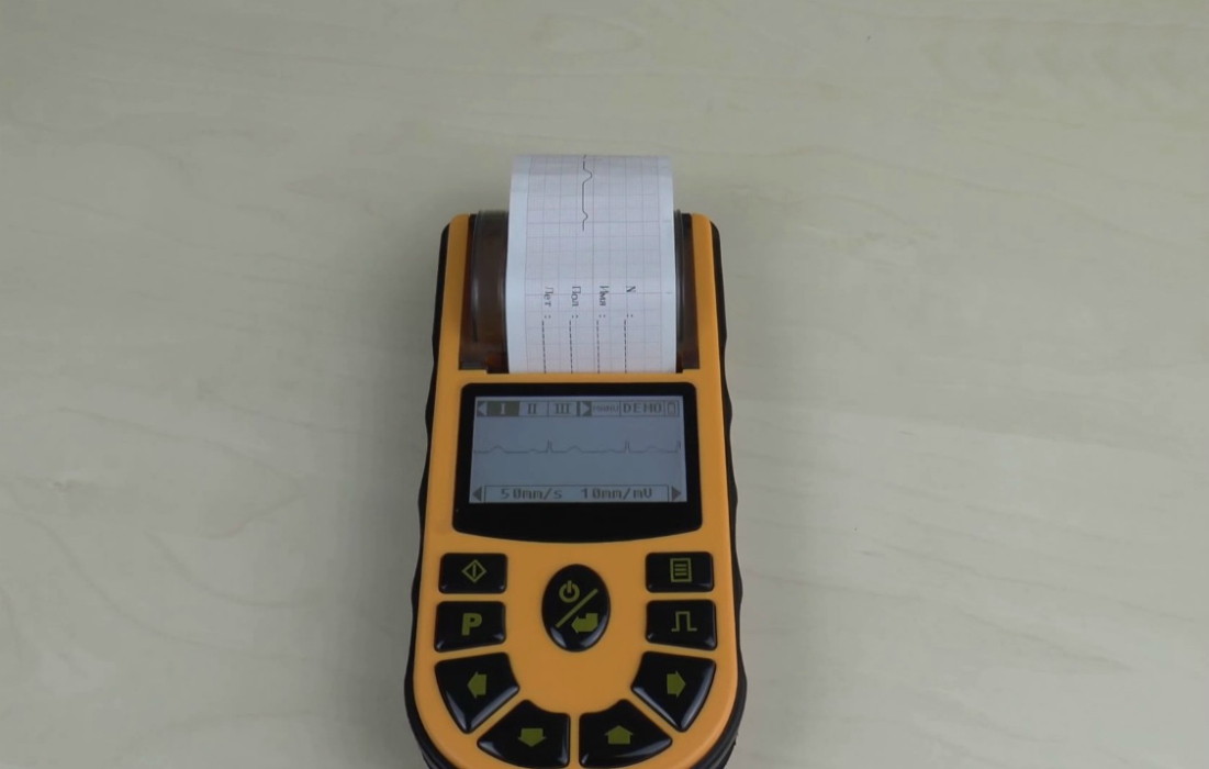 Портативный кардиограф ECG80A Heaco - купить в Медтехника Лайф: цены ...